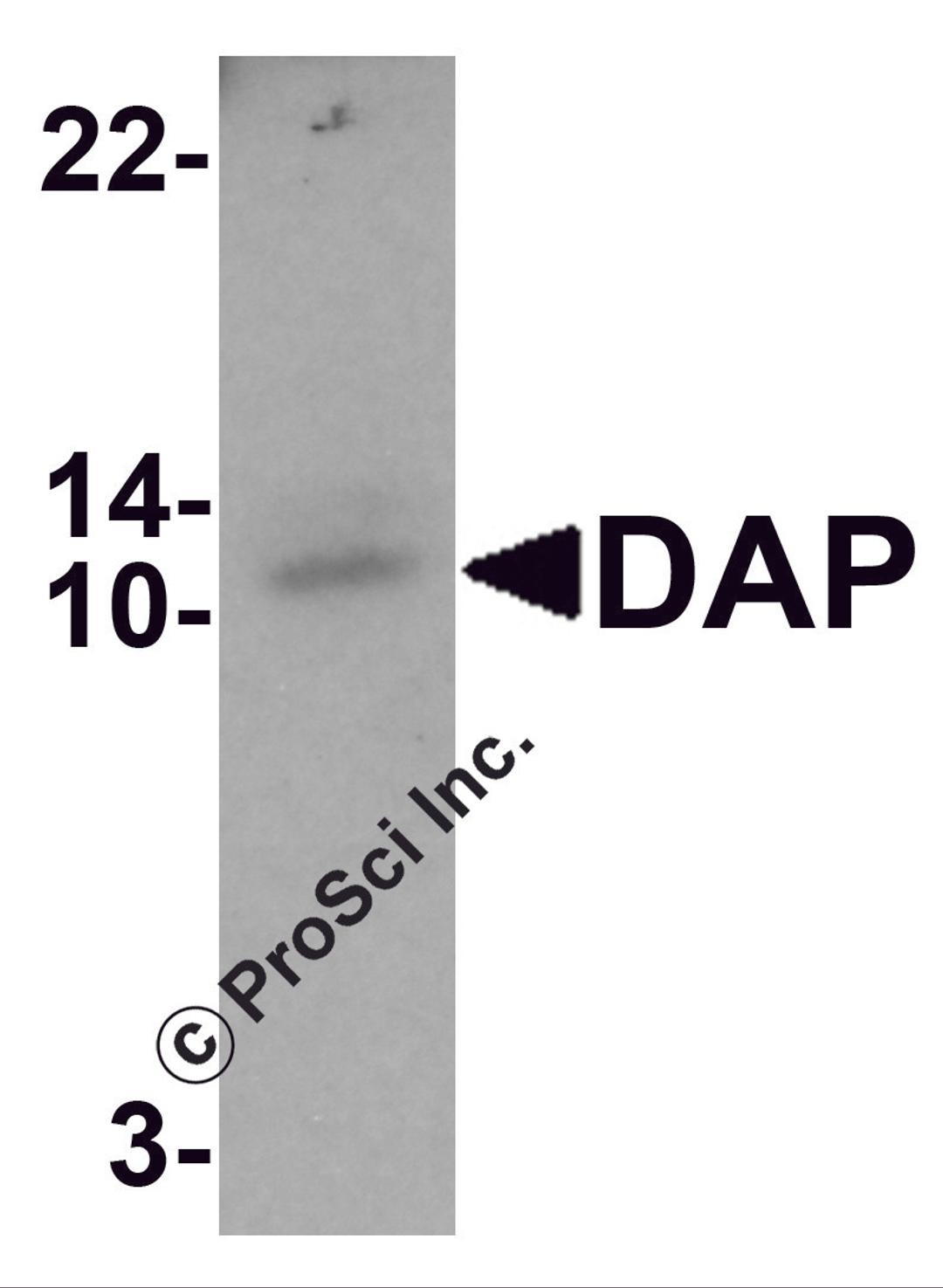 Western blot analysis of DAP in human small intestine tissue lysate with DAP antibody at 1 μg/mL.