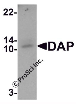 Western blot analysis of DAP in human small intestine tissue lysate with DAP antibody at 1 μg/mL.