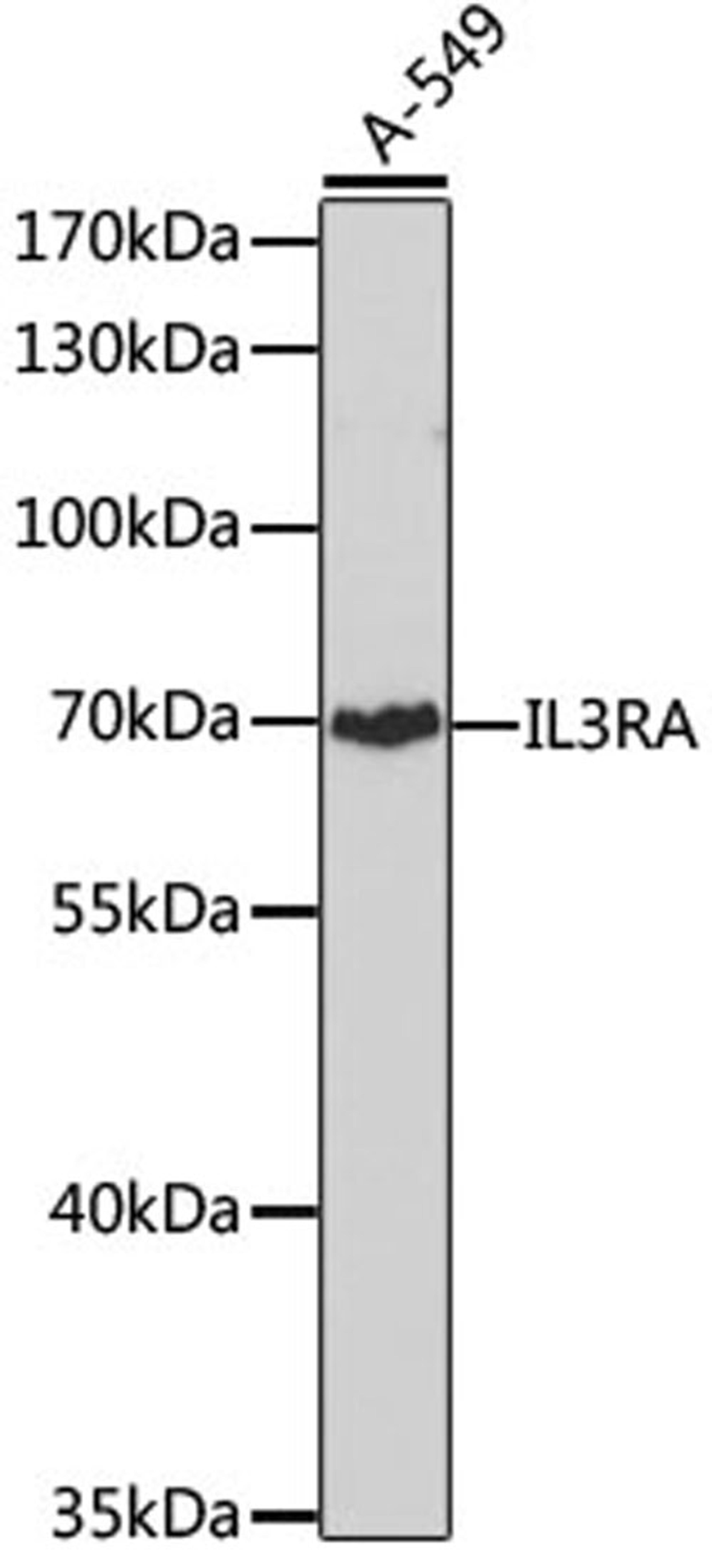 Western blot - IL3RA antibody (A3926)