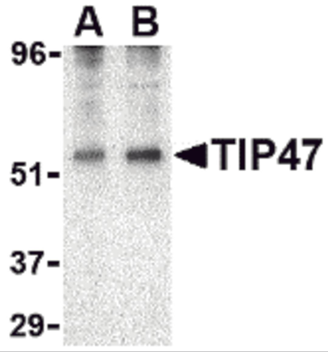 Western blot analysis of TIP47 in EL4 cell lysate with TIP47 antibody at (A) 0.5 and (B) 1 &#956;g/mL.