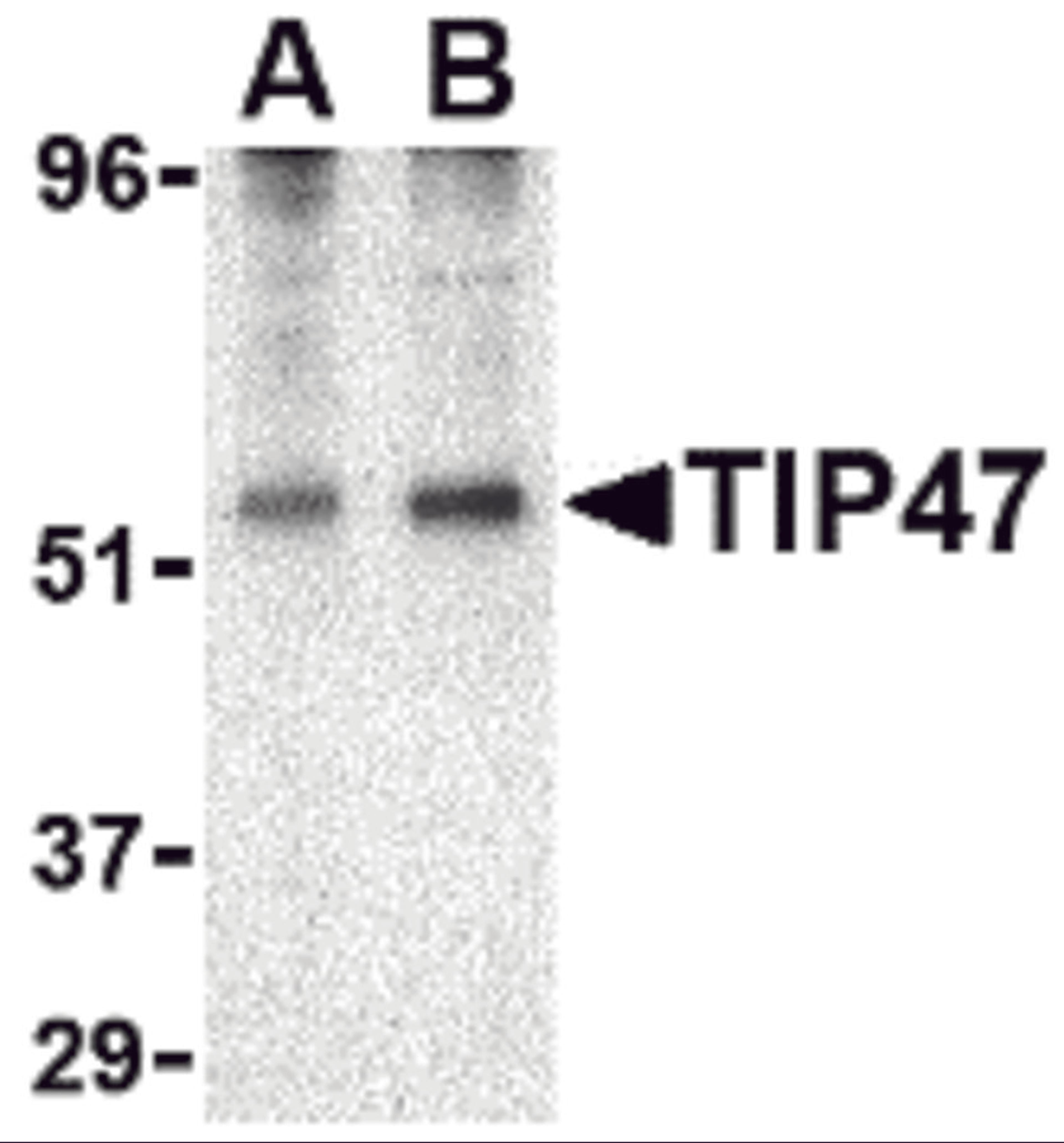 Western blot analysis of TIP47 in EL4 cell lysate with TIP47 antibody at (A) 0.5 and (B) 1 μg/mL.