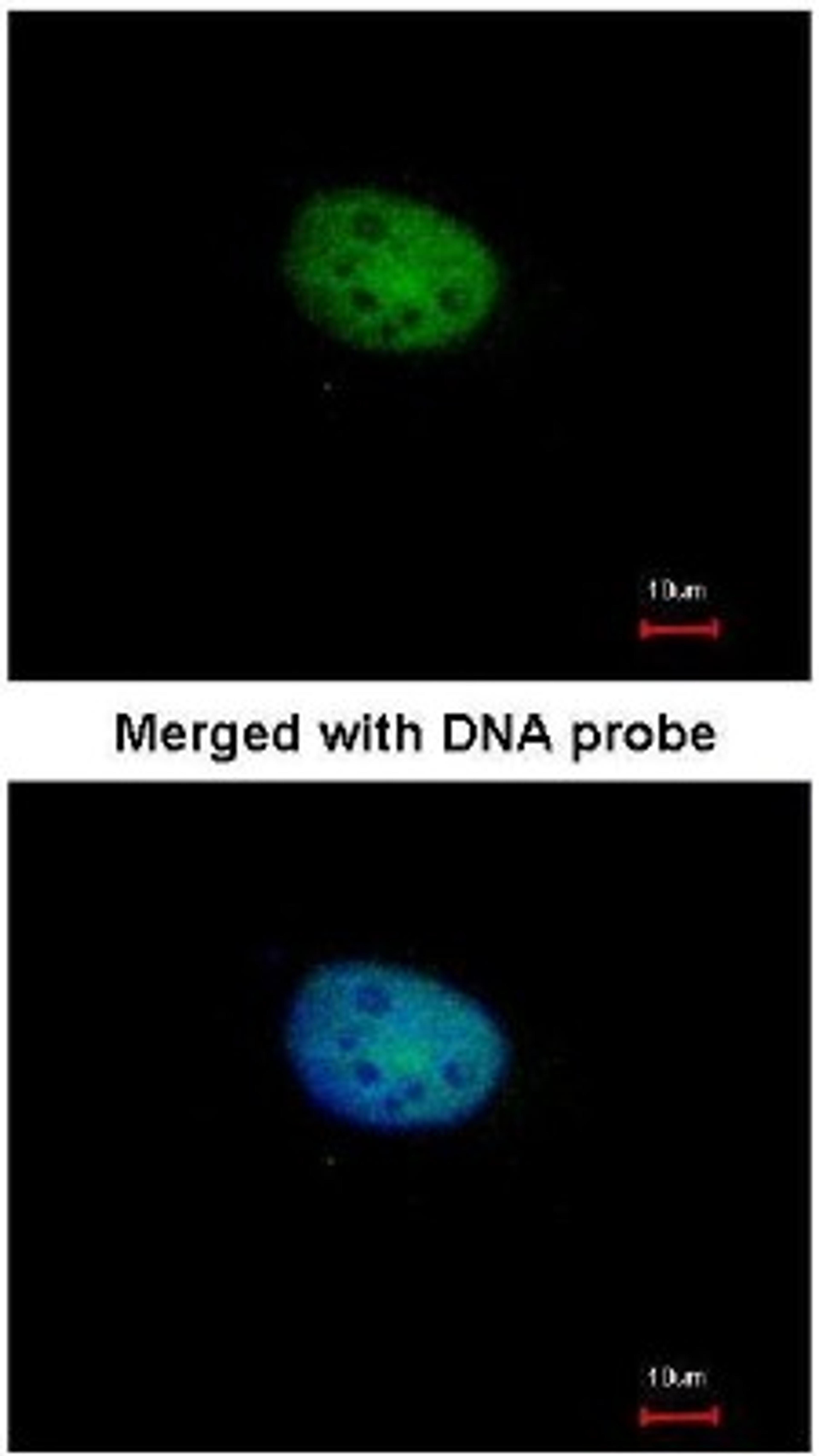 Immunocytochemistry/Immunofluorescence: RBPJK Antibody [NBP1-33427] - Analysis of paraformaldehyde-fixed HeLa, using RBP-Jkappa (NBP1-33427) antibody at 1:100 dilution.