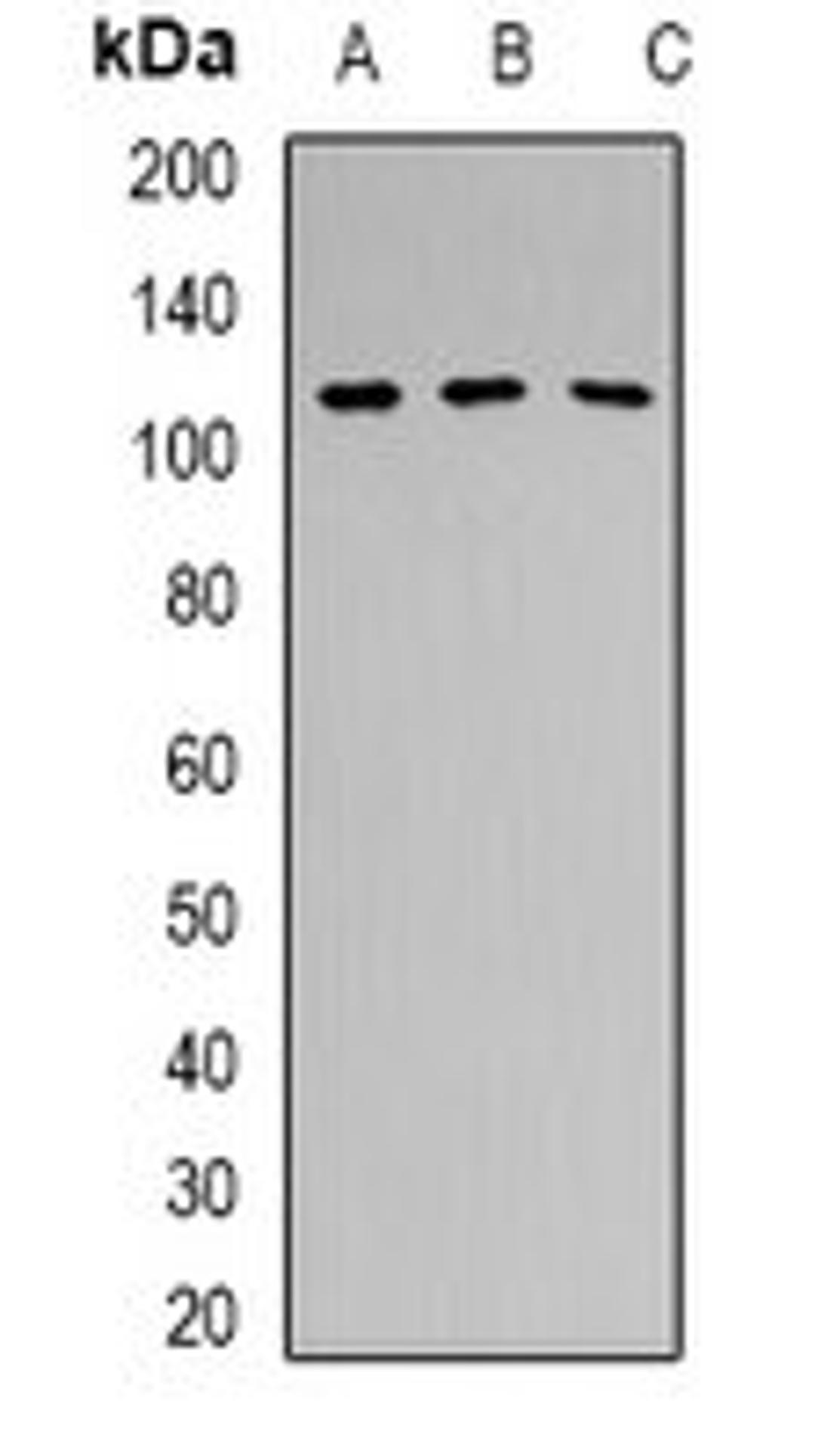 Western blot analysis of Hela (Lane 1), HEK293T (Lane 2), mouse brain (Lane 3) whole cell lysates using PRPF6 antibody