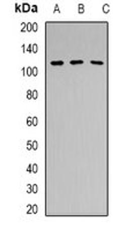 Western blot analysis of Hela (Lane 1), HEK293T (Lane 2), mouse brain (Lane 3) whole cell lysates using PRPF6 antibody