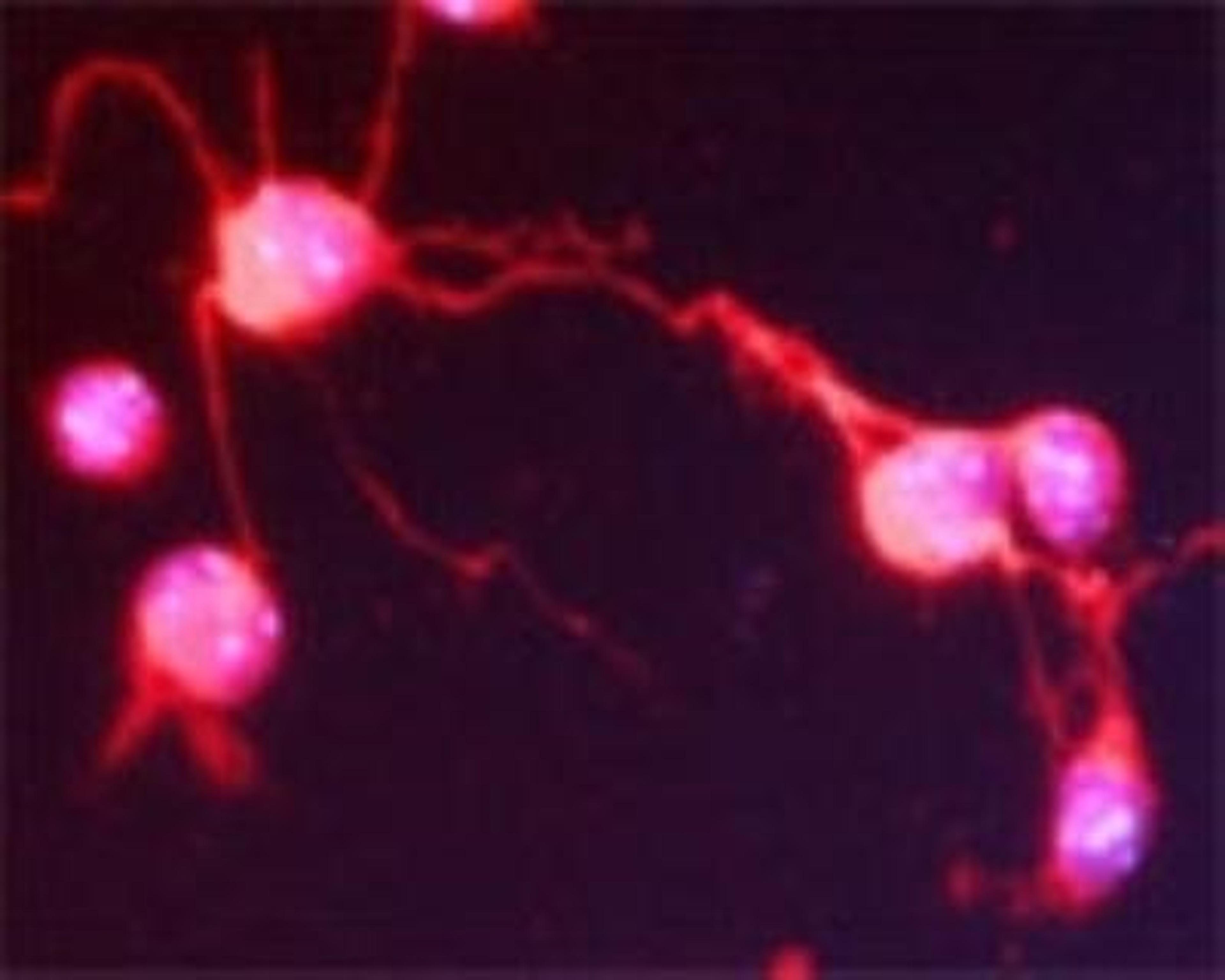 Immunocytochemistry/Immunofluorescence: SNAP25 Interacting Protein Antibody [NBP1-03414] - IF on 1 day- old mouse cortical cell culture using Rabbit antibody to n-terminal of SNIP (SNAP 25 interacting protein): whole serum (NBP1-03414) at 1:2000 dilution. DAPI counter stained.