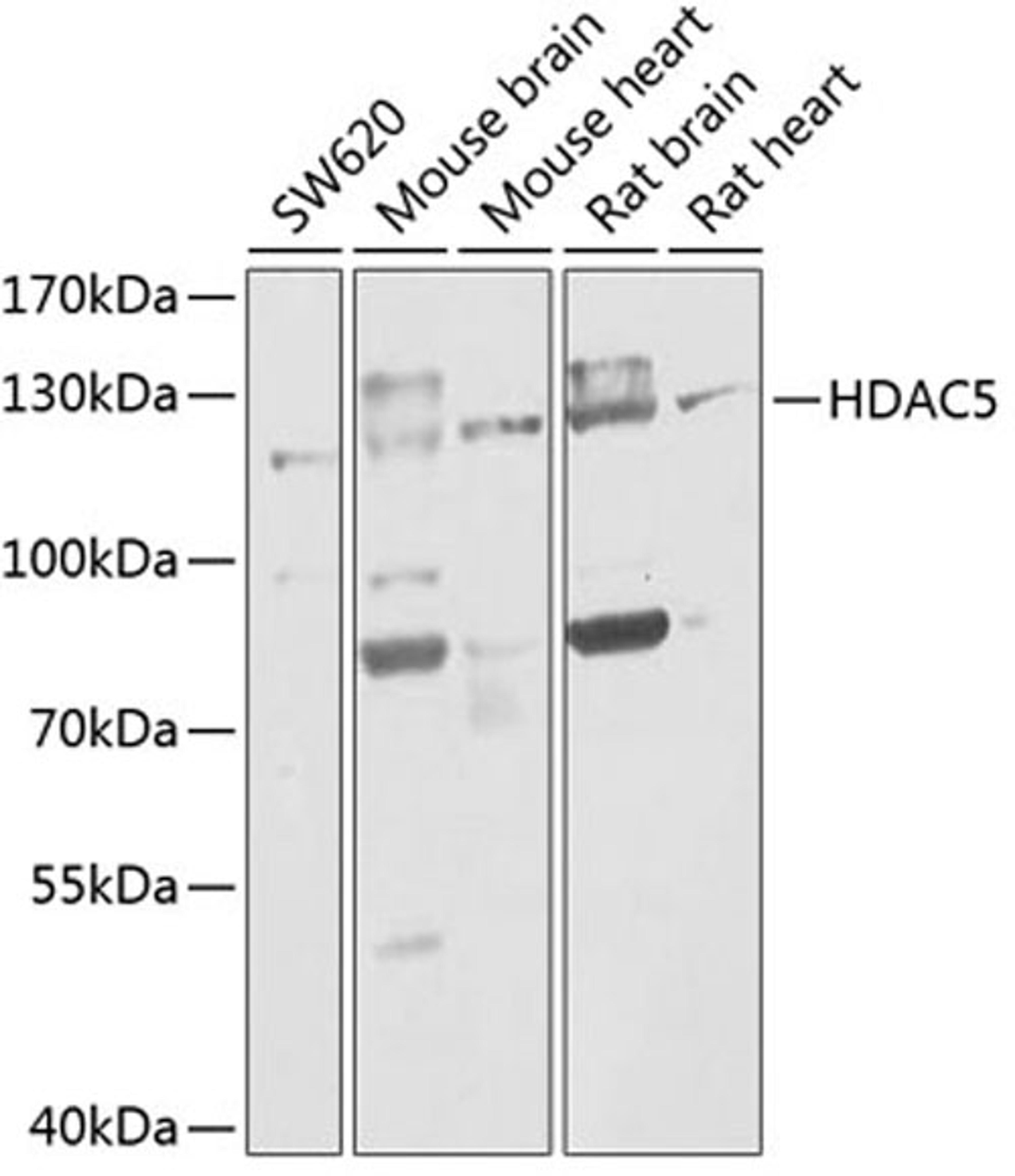 Western blot - HDAC5 antibody (A0632)