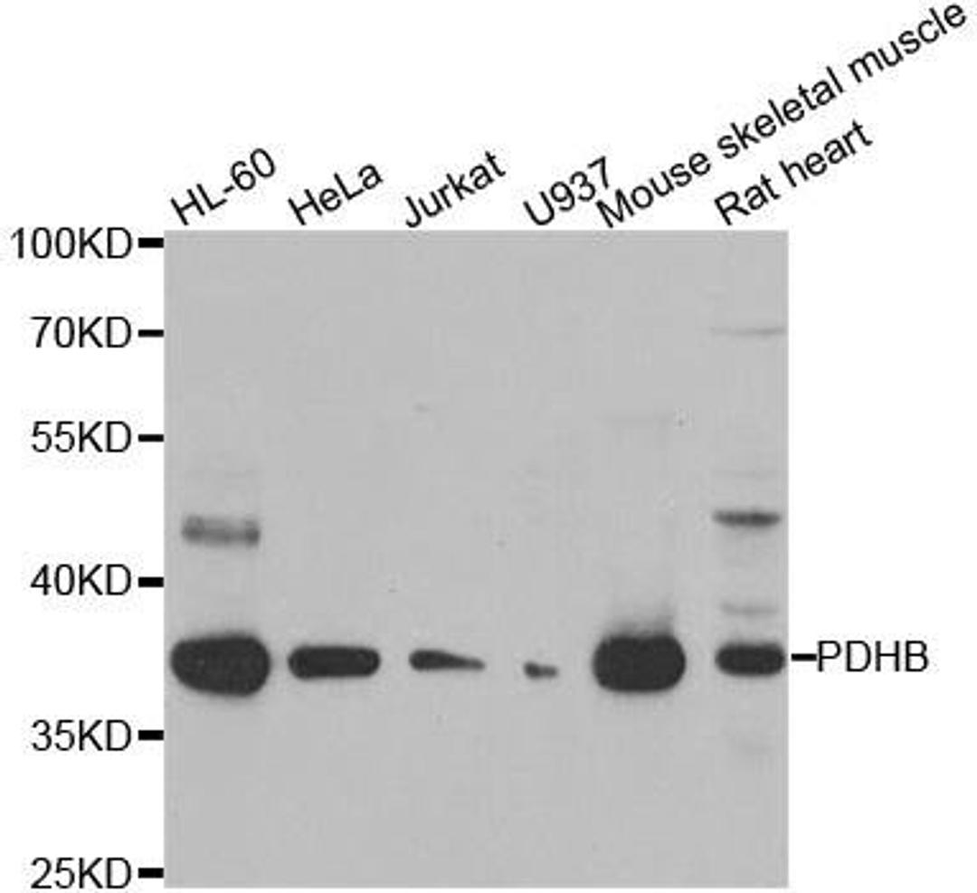 Western blot analysis of extracts of various cell lines using PDHB antibody