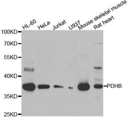 Western blot analysis of extracts of various cell lines using PDHB antibody