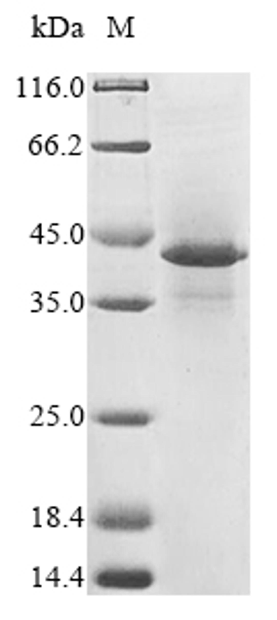 (Tris-Glycine gel) Discontinuous SDS-PAGE (reduced) with 5% enrichment gel and 15% separation gel.