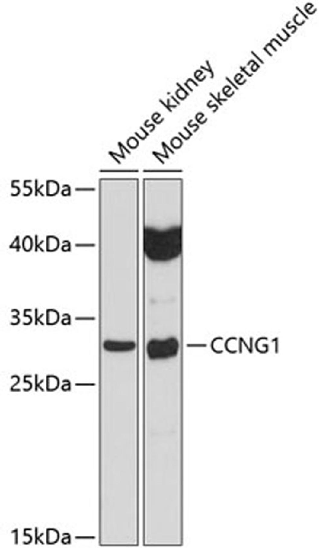 Western blot - CCNG1 antibody (A5292)