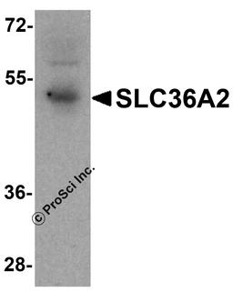 Western blot analysis of SLC36A2 in human stomach tissue lysate with SLC36A2 antibody at1 μg/ml.