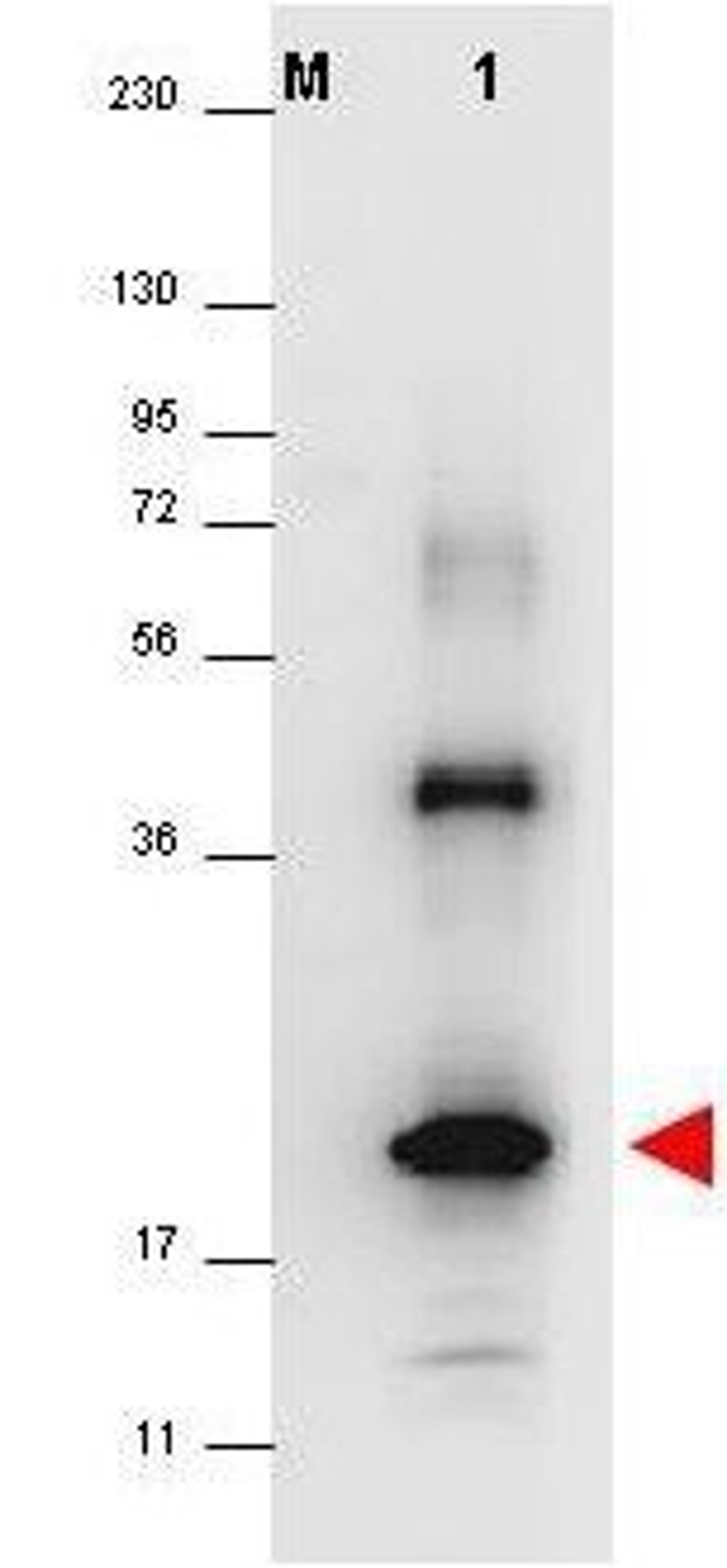 Western blot analysis of (lane 1). The identity of the higher molecular weight band is unknown. Molecular weight markers are also shown (M). After transfer, the membrane was blocked overnight with 3% BSA in TBS followed by reaction with primary antibody a