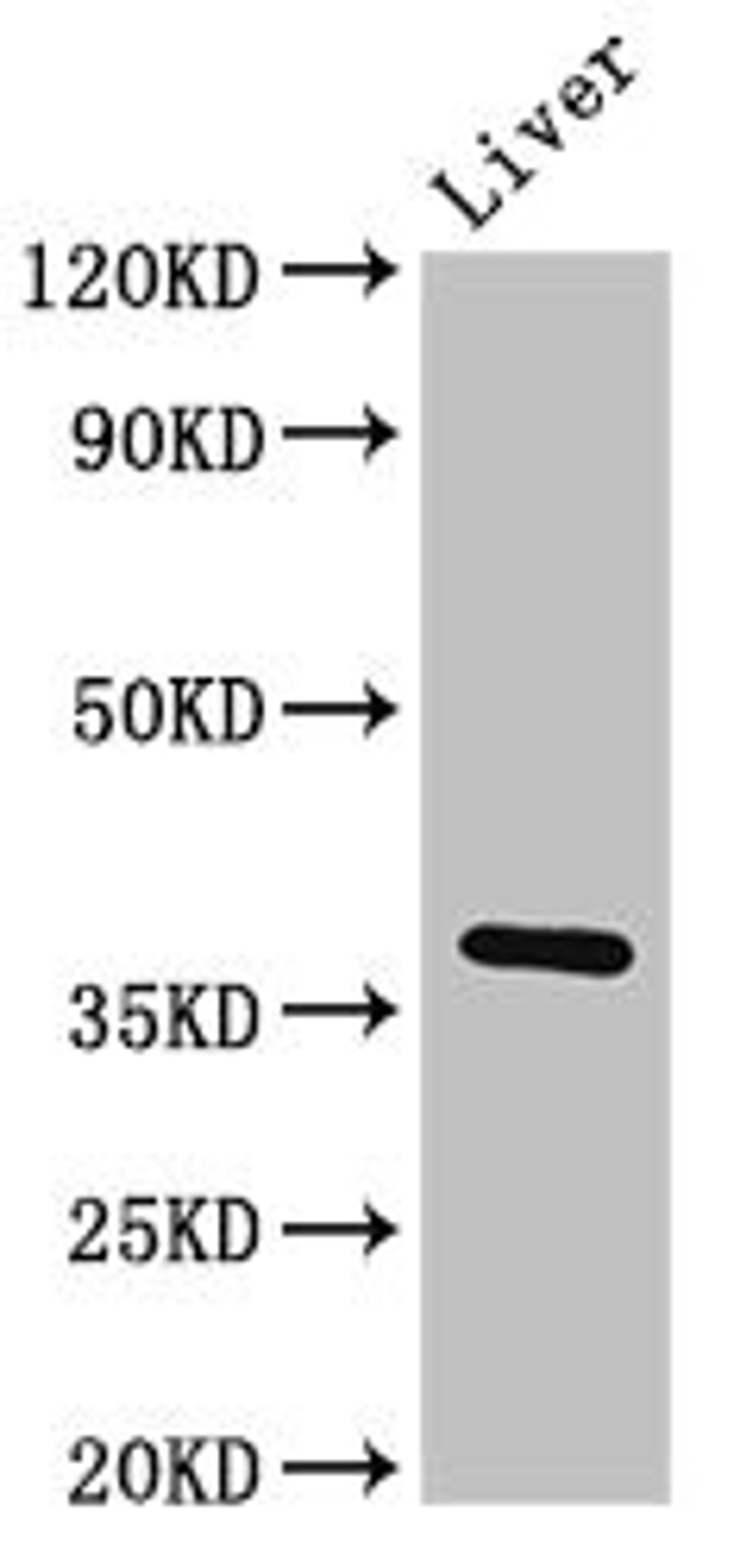 Western Blot. Positive WB detected in: Rat liver tissue. All lanes: Ppp1cb antibody at 3ug/ml. Secondary. Goat polyclonal to rabbit IgG at 1/50000 dilution. Predicted band size: 38 kDa. Observed band size: 38 kDa.