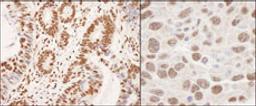 Detection of human and mouse hnRNP-K by immunohistochemistry.