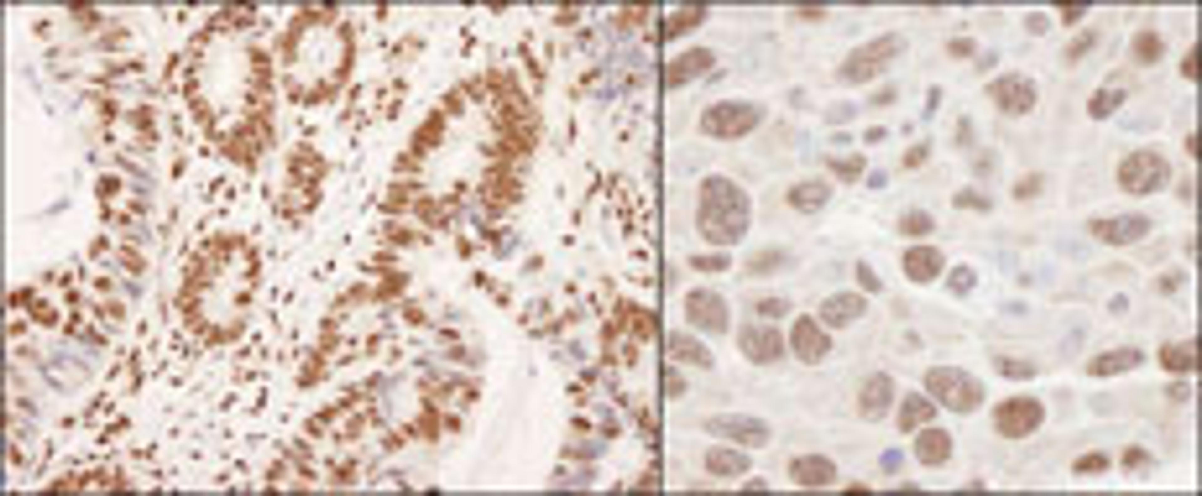 Detection of human and mouse hnRNP-K by immunohistochemistry.