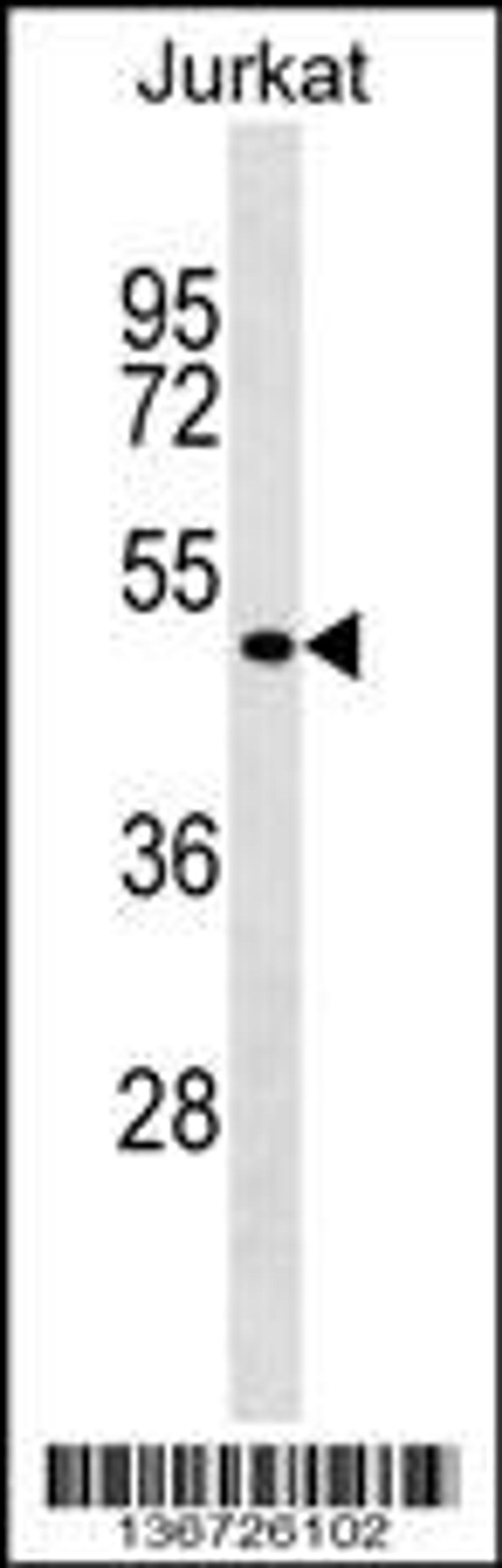 Western blot analysis in Jurkat cell line lysates (35ug/lane).