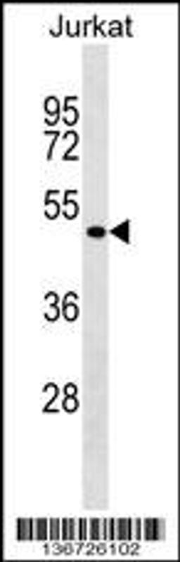 Western blot analysis in Jurkat cell line lysates (35ug/lane).