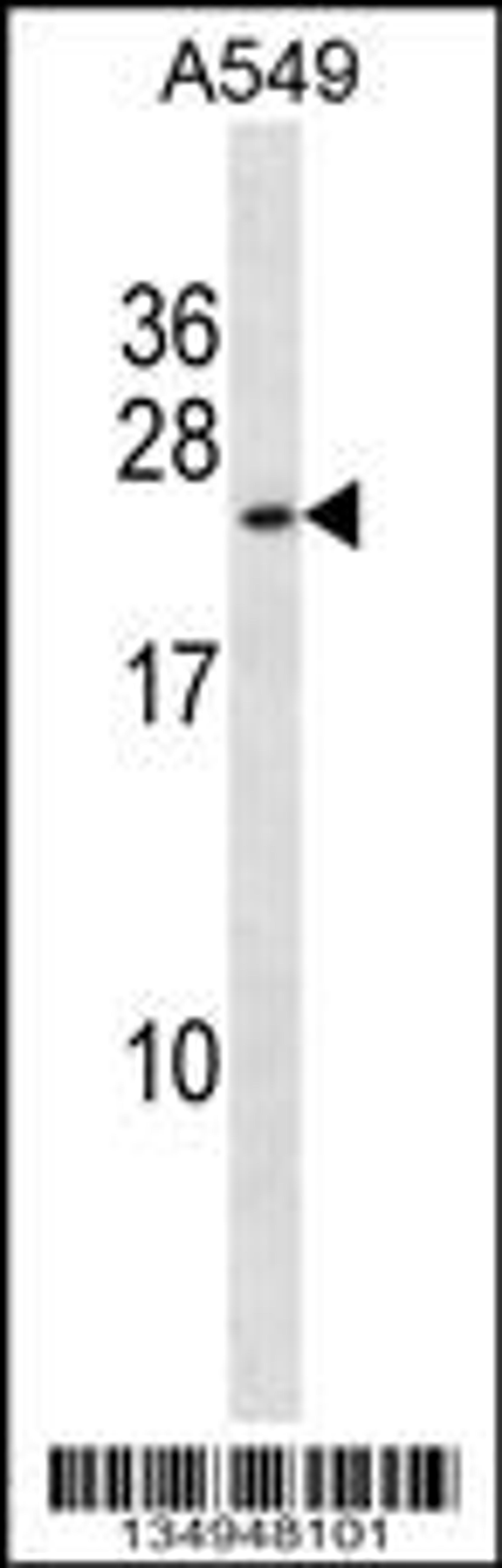 Western blot analysis in A549 cell line lysates (35ug/lane).