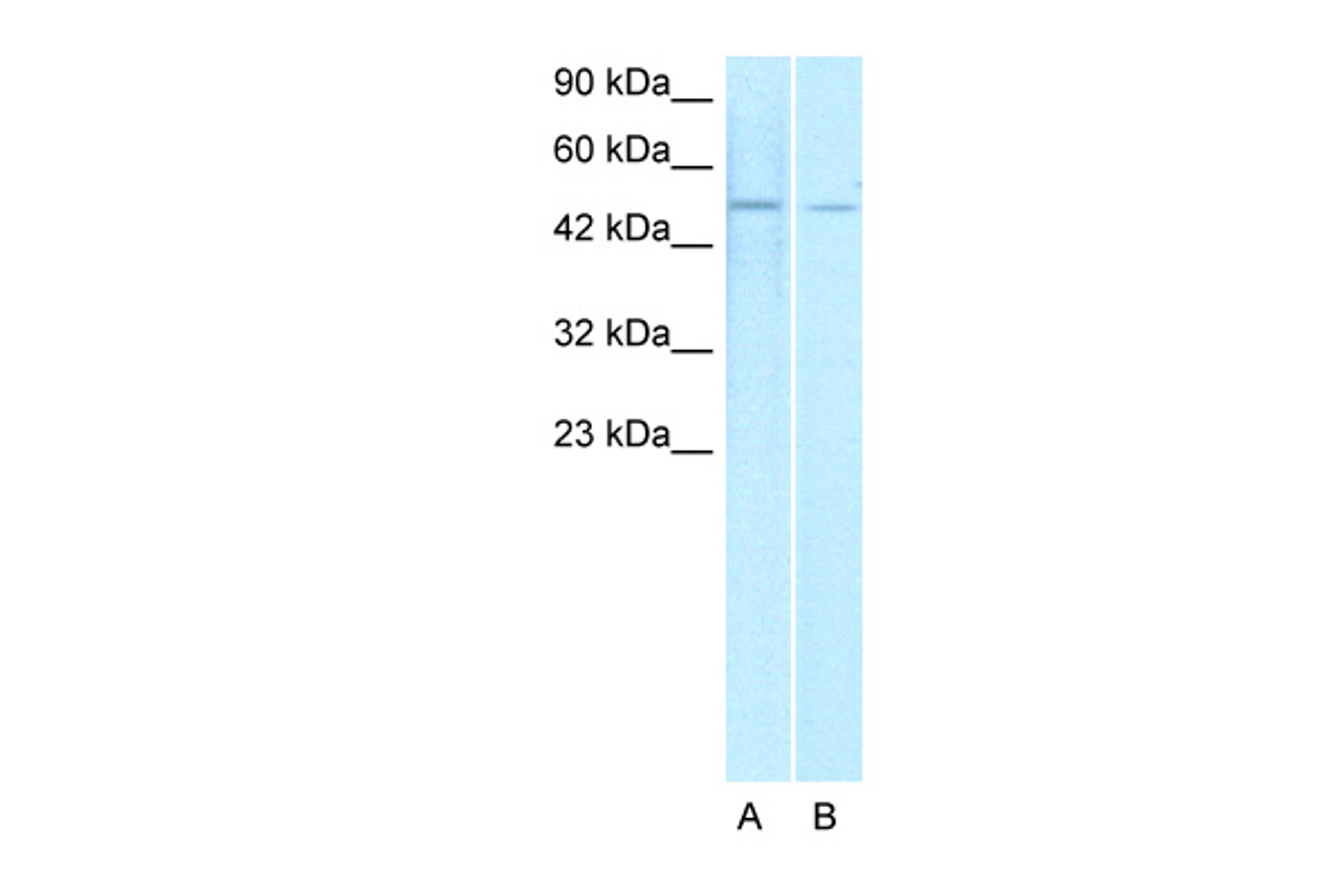 Antibody used in WB on Human Jurkat 1 ug/ml.