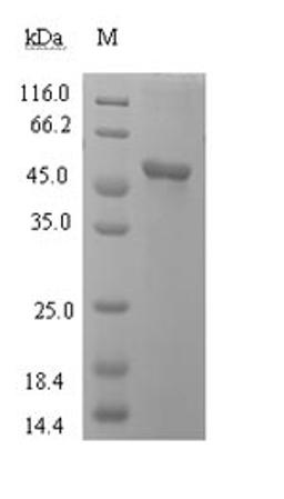 (Tris-Glycine gel) Discontinuous SDS-PAGE (reduced) with 5% enrichment gel and 15% separation gel.