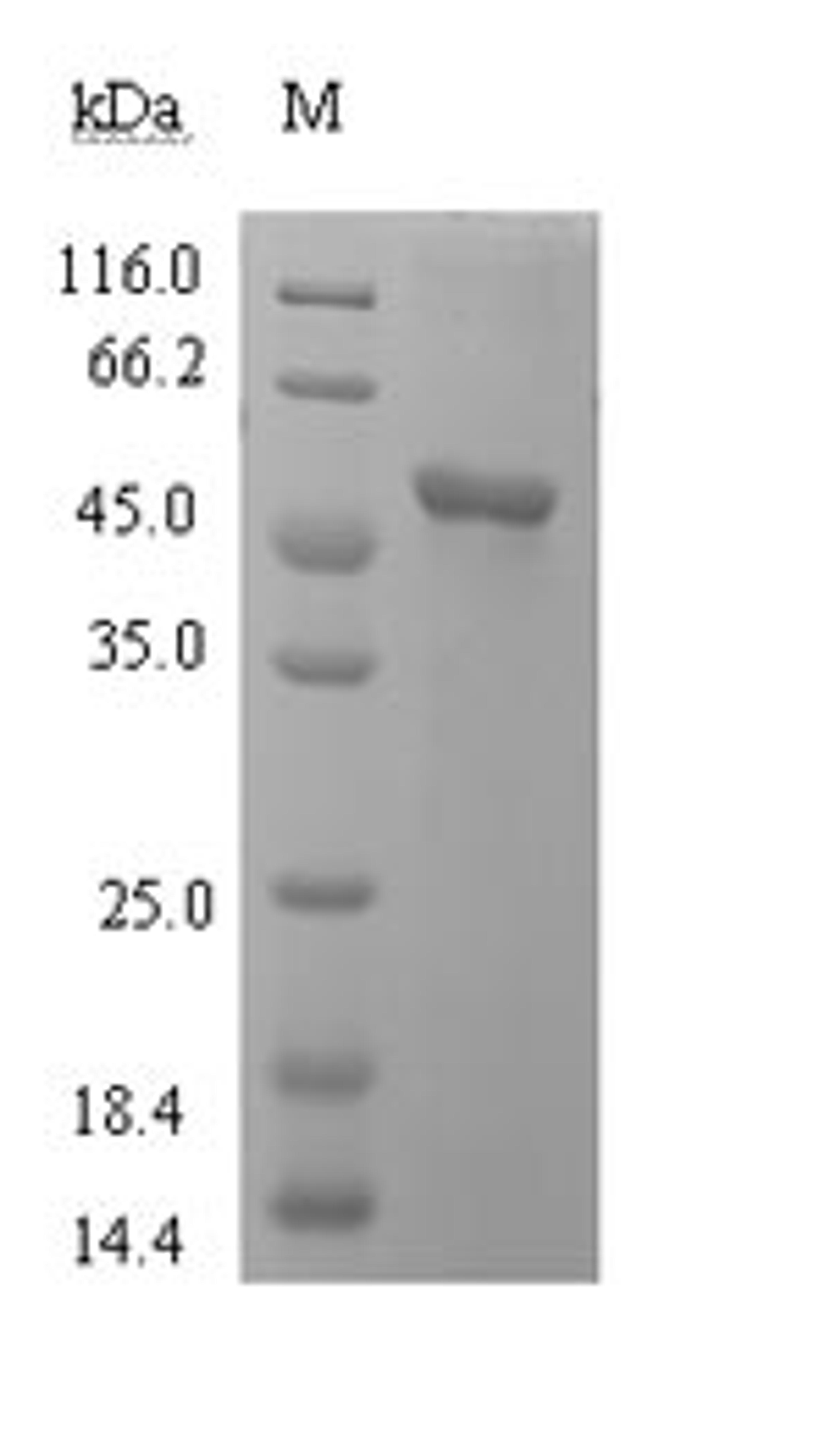 (Tris-Glycine gel) Discontinuous SDS-PAGE (reduced) with 5% enrichment gel and 15% separation gel.