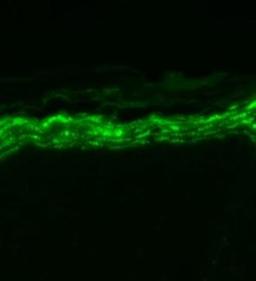 Immunocytochemistry: Nav1.7 Antibody (S68-6) [NBP2-12904] - Backskin sections using this antibody.