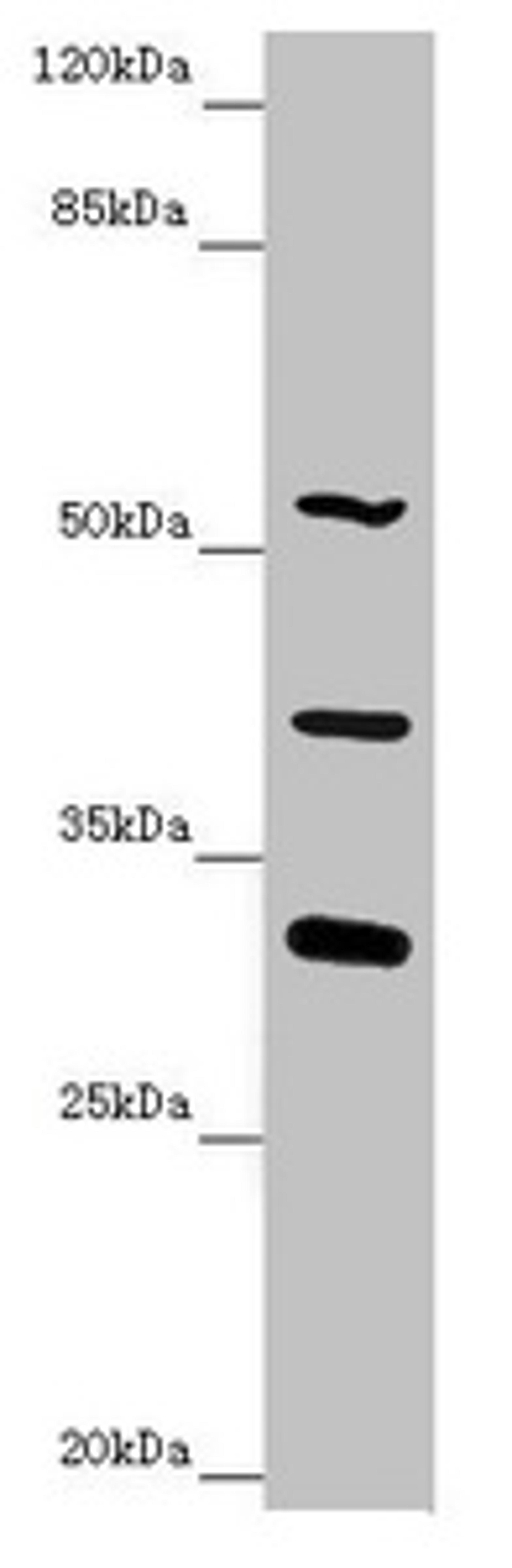 Western blot. All lanes: NYX antibody at 4.91 ug/ml.  + Mouse liver tissue. Secondary. Goat polyclonal to rabbit IgG at 1/10000 dilution. Predicted band size: 52 kDa. Observed band size: 52, 32, 39 kDa. 