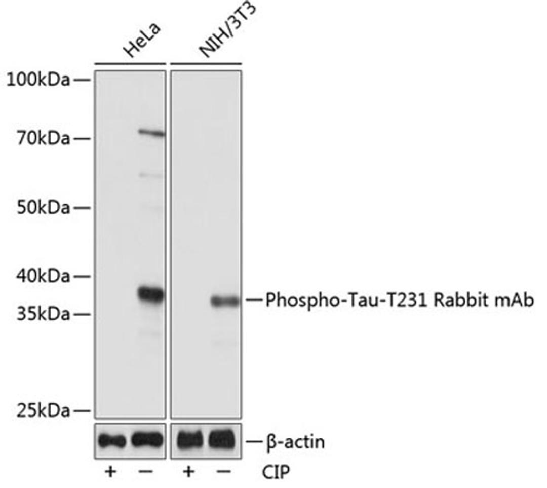 Western blot - Phospho-Tau-T231 Rabbit mAb (AP0053)