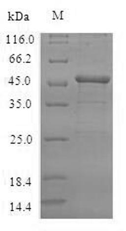 (Tris-Glycine gel) Discontinuous SDS-PAGE (reduced) with 5% enrichment gel and 15% separation gel.