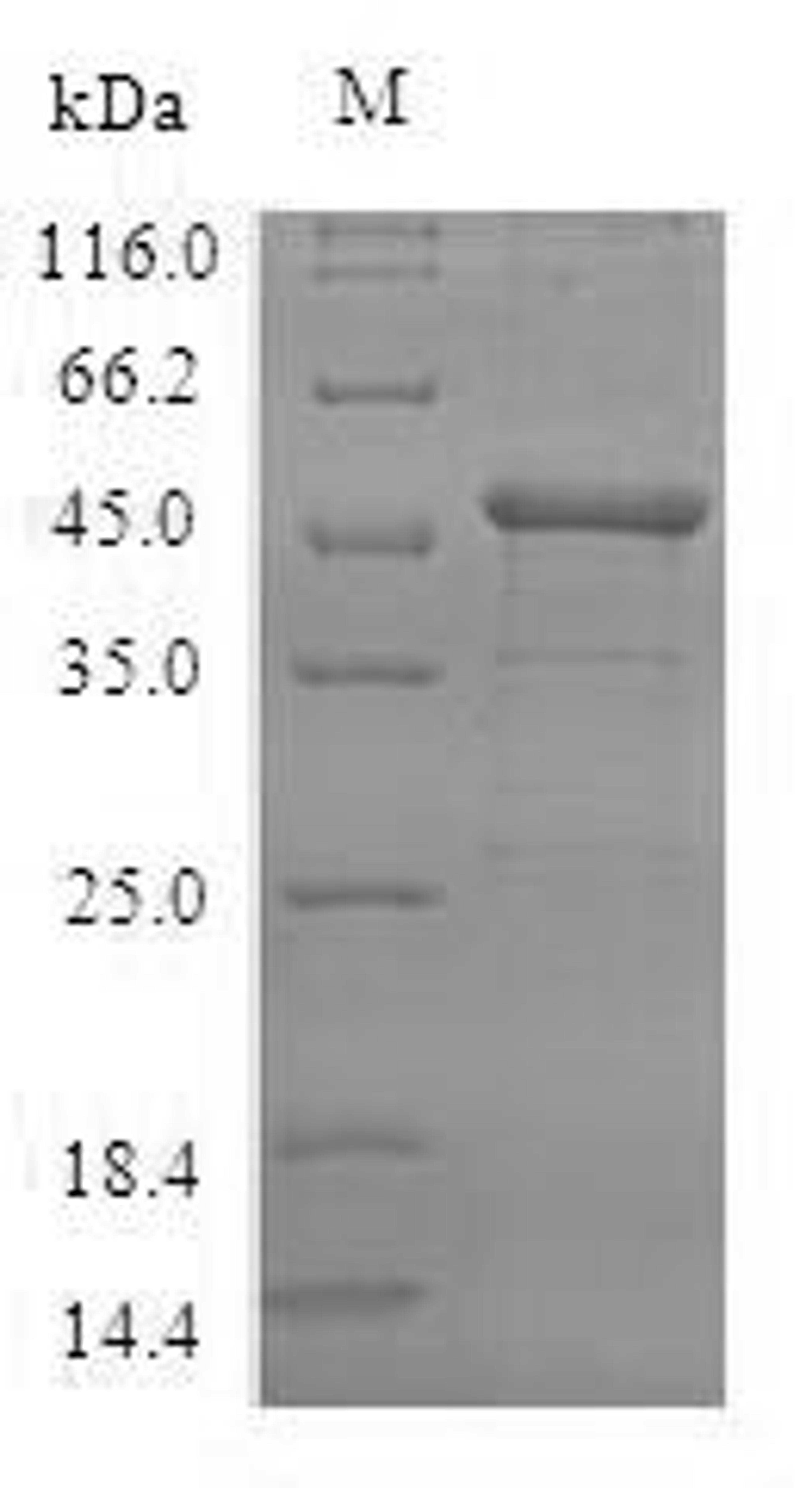 (Tris-Glycine gel) Discontinuous SDS-PAGE (reduced) with 5% enrichment gel and 15% separation gel.