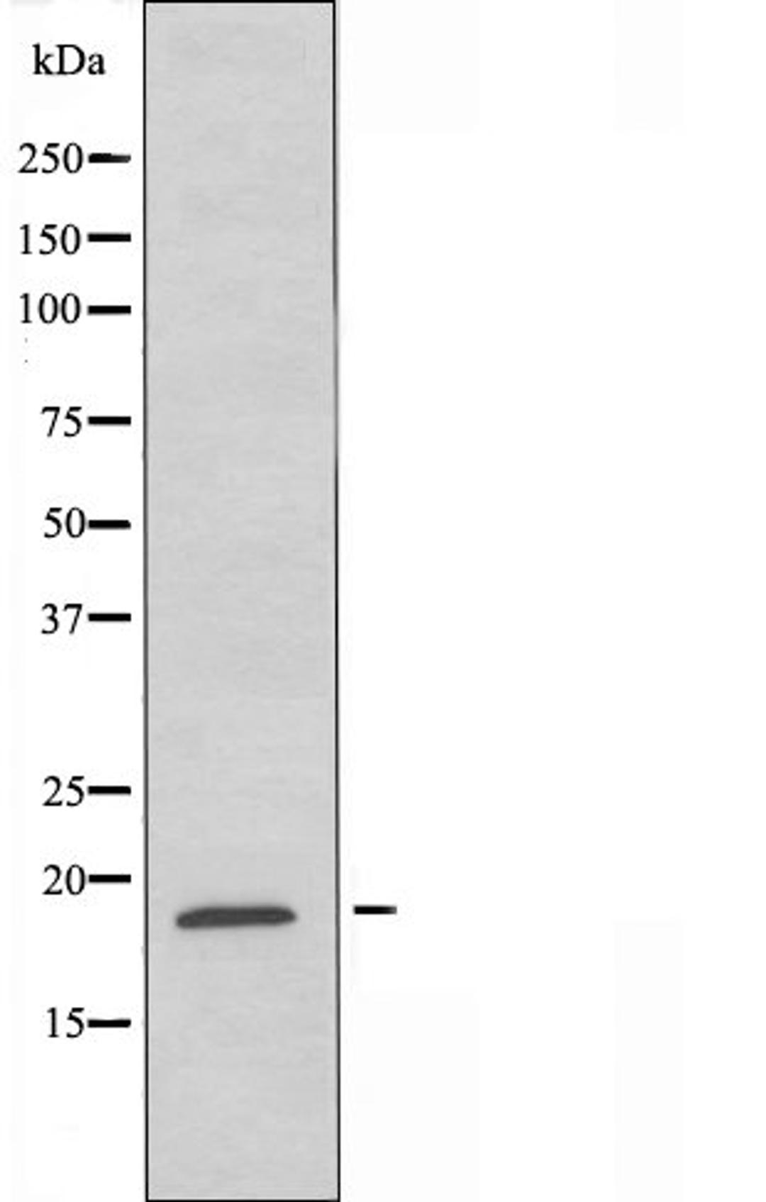 Western blot analysis of K562 cells using GUSBL1 antibody