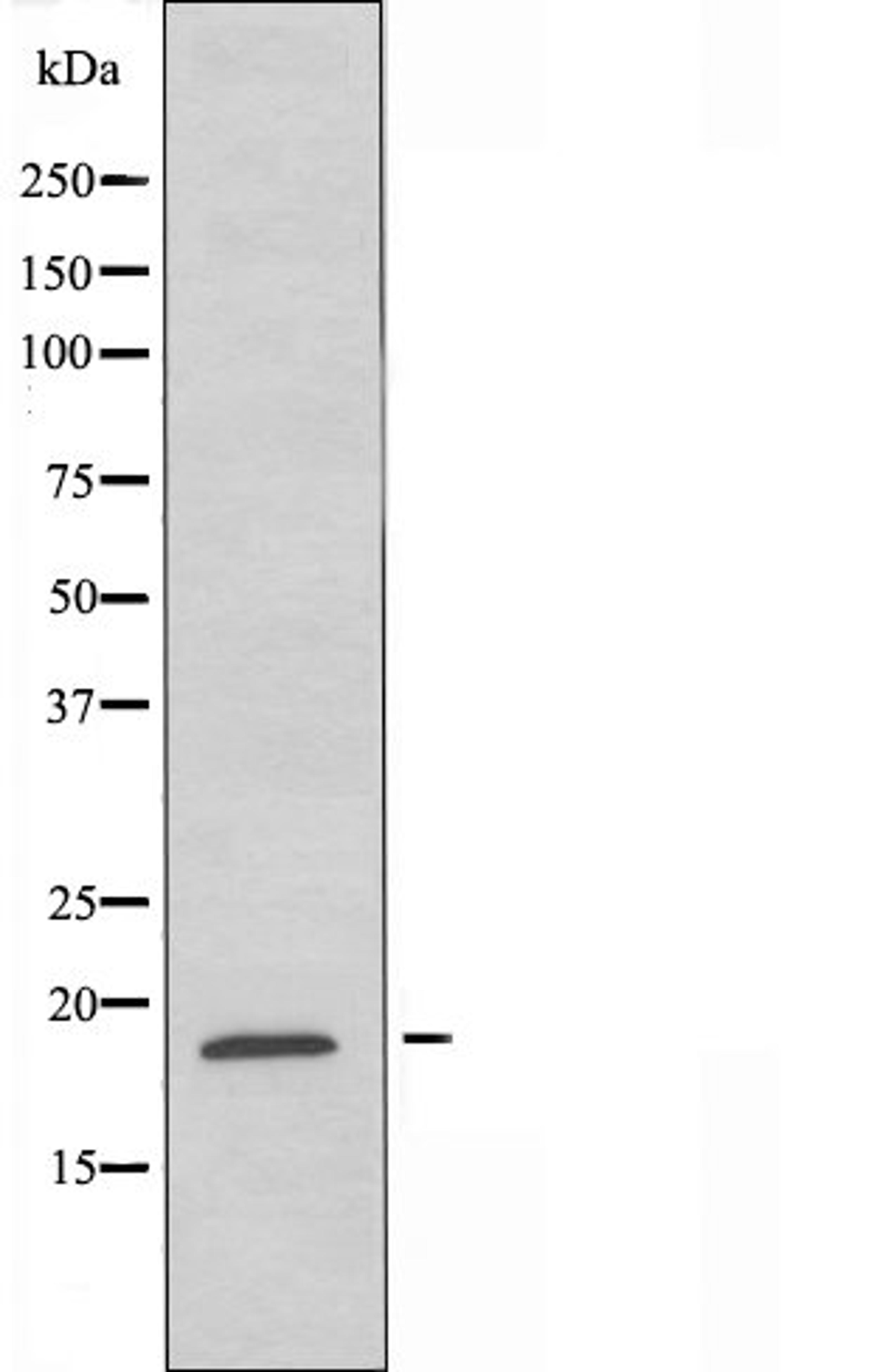 Western blot analysis of K562 cells using GUSBL1 antibody