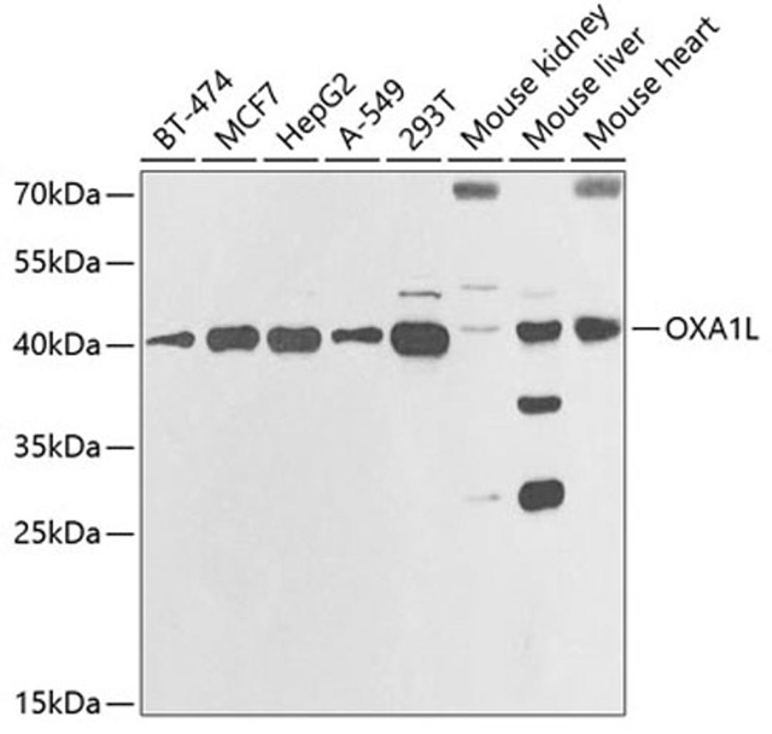 Western blot - OXA1L antibody (A6300)