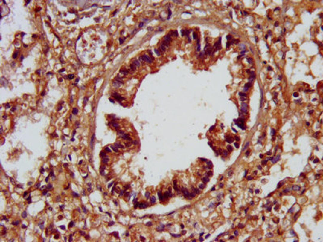 IHC image of CSB-PA733819LA01HU diluted at 1:200 and staining in paraffin-embedded human lung tissue performed on a Leica BondTM system. After dewaxing and hydration, antigen retrieval was mediated by high pressure in a citrate buffer (pH 6.0). Section was blocked with 10% normal goat serum 30min at RT. Then primary antibody (1% BSA) was incubated at 4°C overnight. The primary is detected by a biotinylated secondary antibody and visualized using an HRP conjugated SP system.