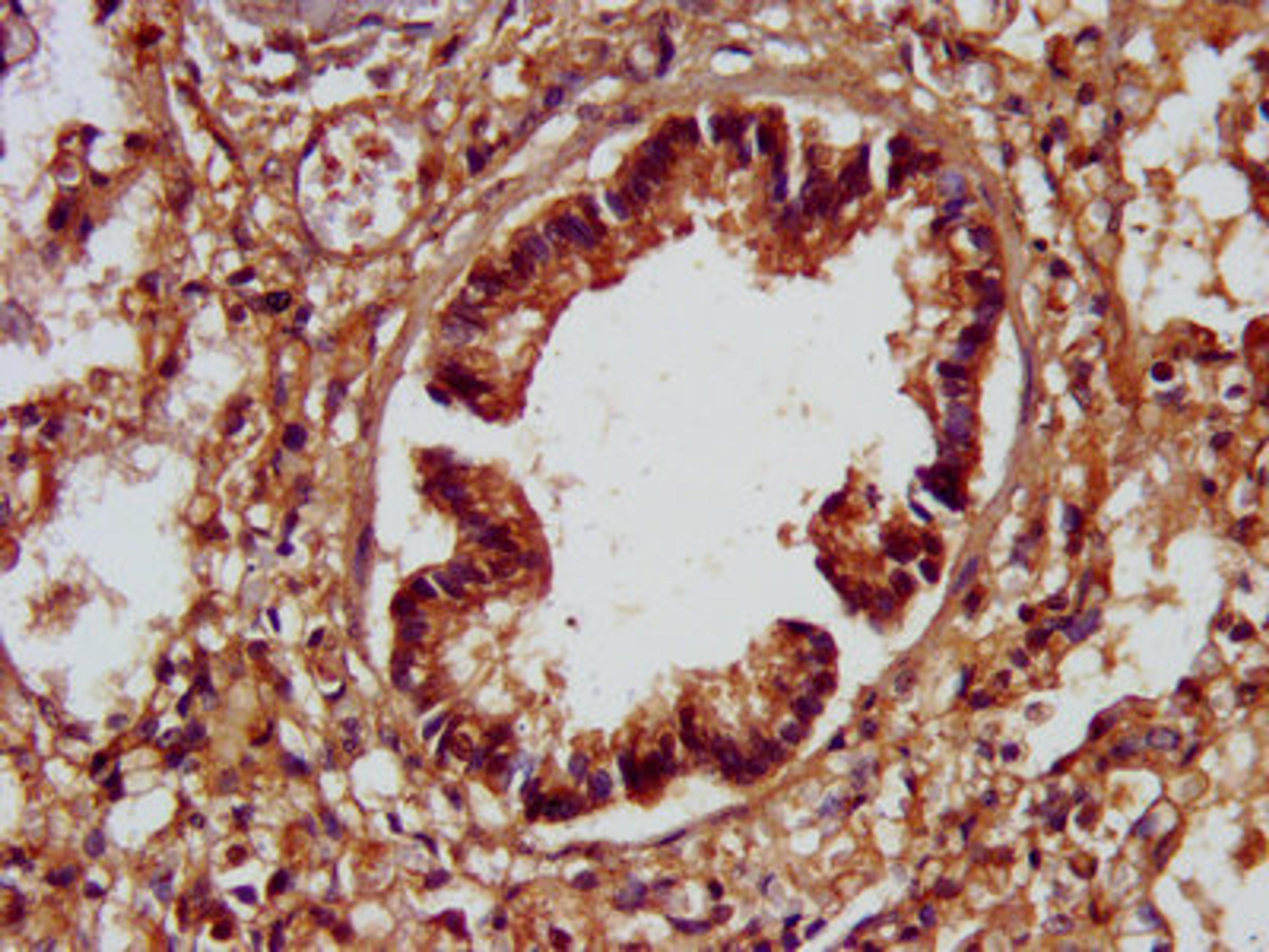 IHC image of CSB-PA733819LA01HU diluted at 1:200 and staining in paraffin-embedded human lung tissue performed on a Leica BondTM system. After dewaxing and hydration, antigen retrieval was mediated by high pressure in a citrate buffer (pH 6.0). Section was blocked with 10% normal goat serum 30min at RT. Then primary antibody (1% BSA) was incubated at 4°C overnight. The primary is detected by a biotinylated secondary antibody and visualized using an HRP conjugated SP system.