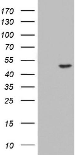 Western Blot: Casein Kinase 1 gamma 2 Antibody (4H3) [NBP2-46385] - Analysis of HEK293T cells were transfected with the pCMV6-ENTRY control (Left lane) or pCMV6-ENTRY Casein Kinase 1 gamma 2.