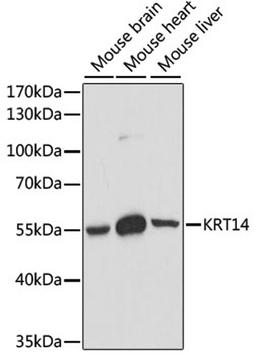 Western blot - KRT14 antibody (A15069)