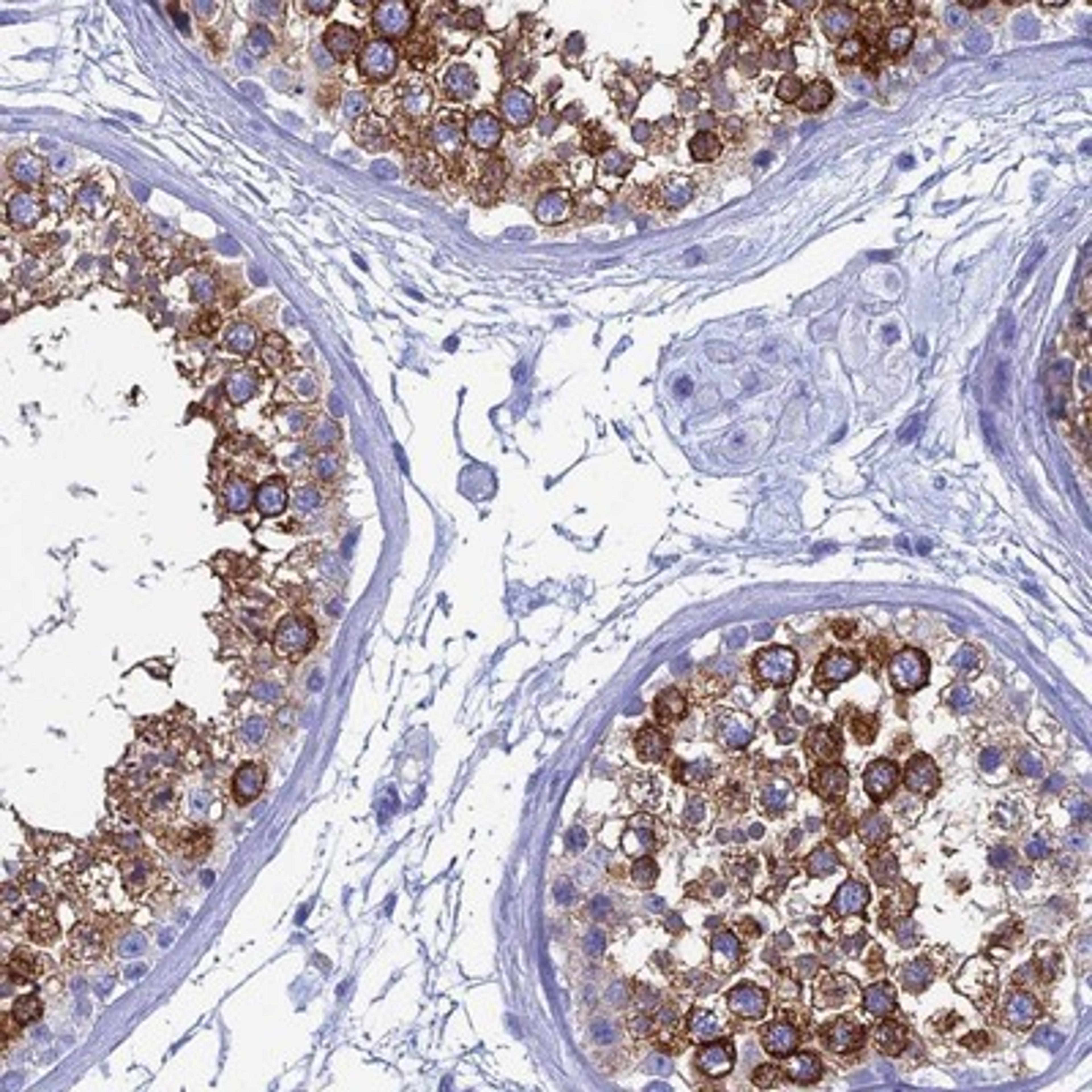 Immunohistochemistry-Paraffin: TEX101 Antibody [NBP1-84357] - Staining of human testis shows strong cytoplasmic positivity in cells in seminiferus ducts.