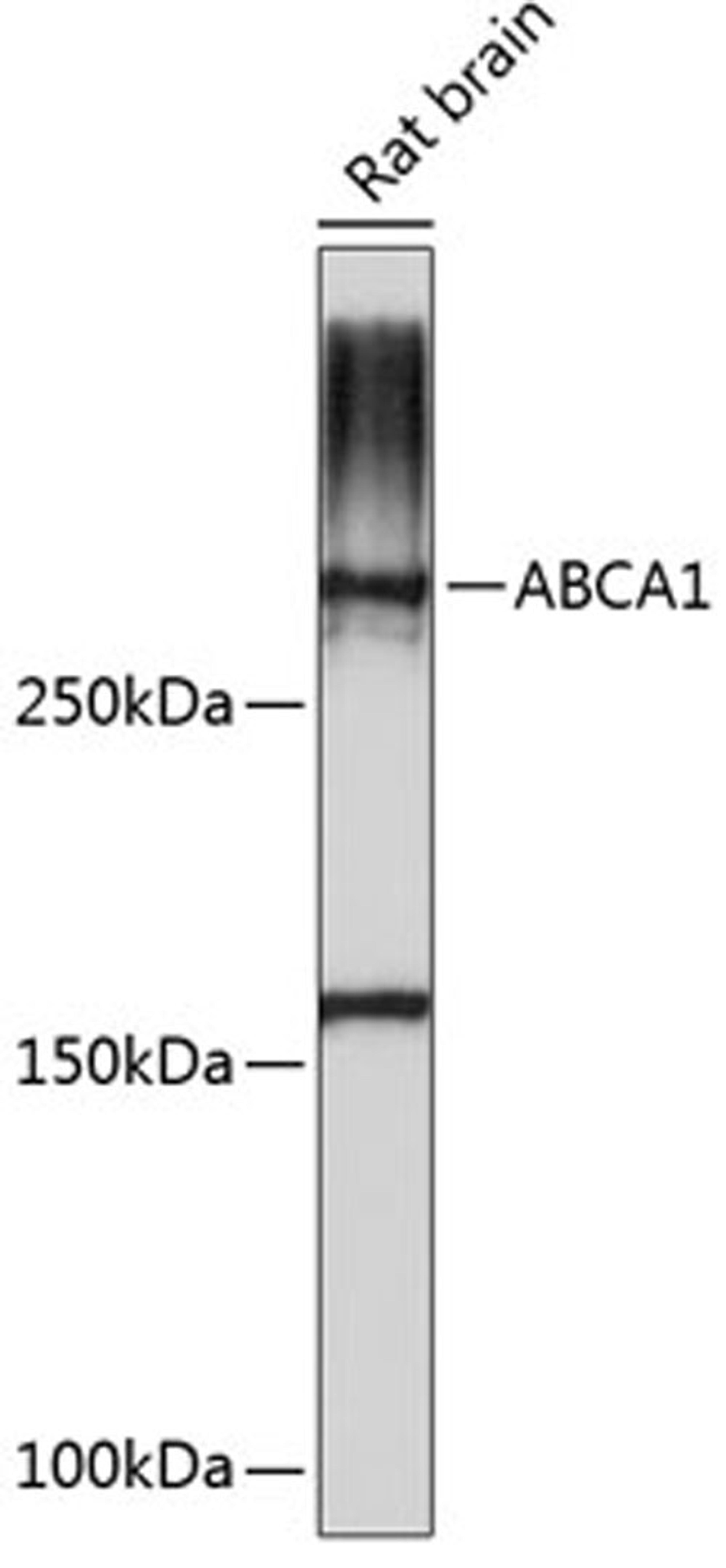 Western blot - ABCA1 Polyclonal Antibody (A16337)