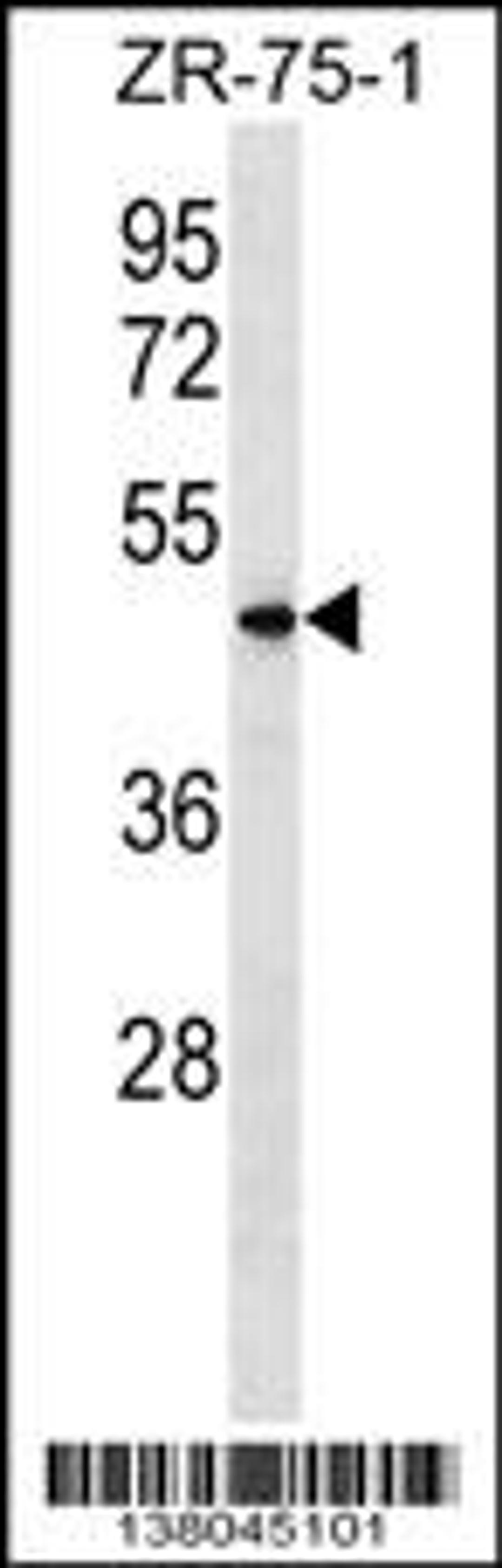 Western blot analysis in ZR-75-1 cell line lysates (35ug/lane).