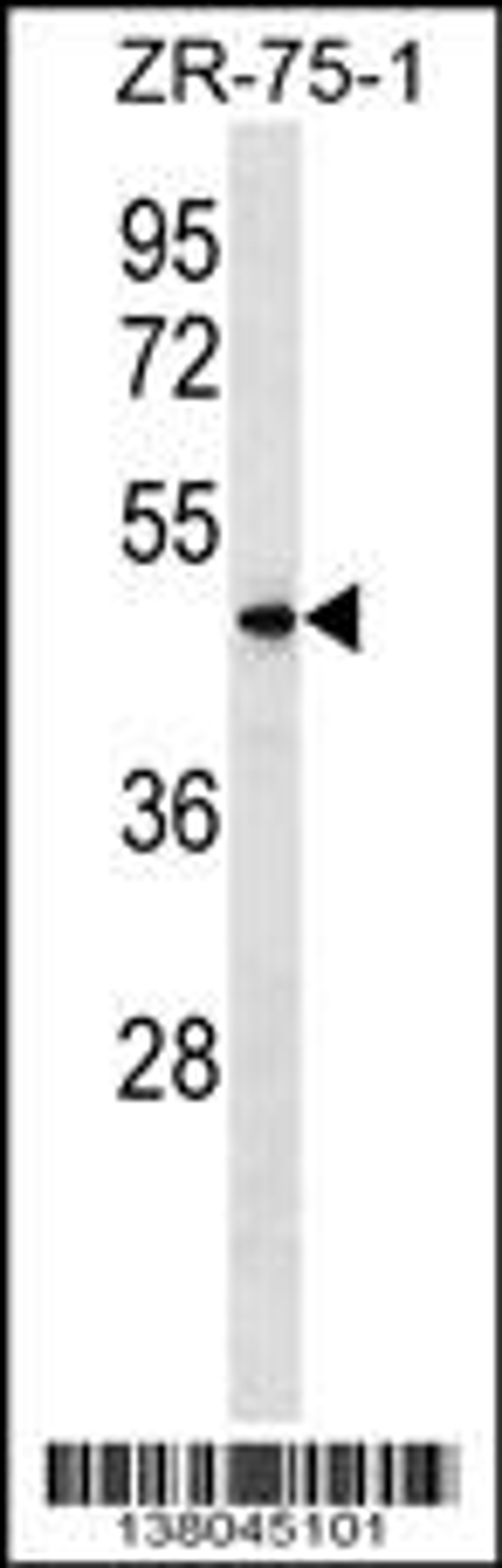 Western blot analysis in ZR-75-1 cell line lysates (35ug/lane).