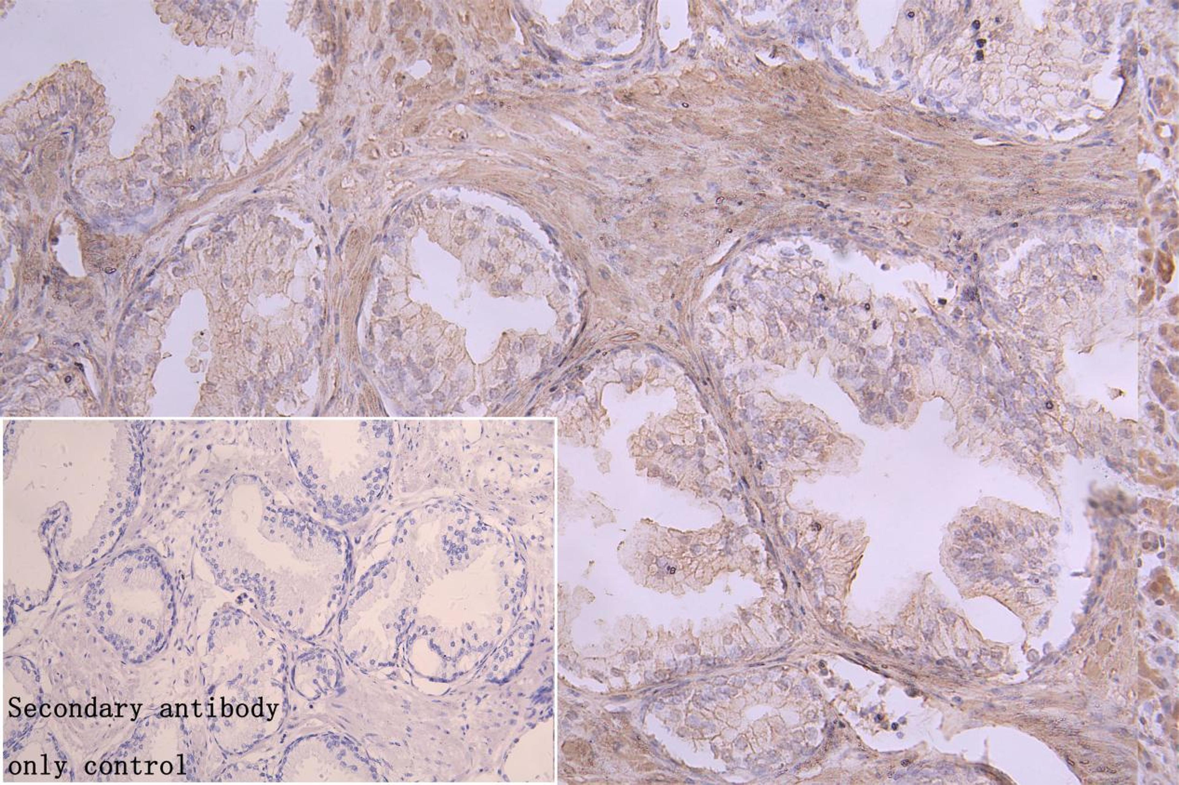 Immunohistochemistry of paraffin-embedded human brain tissue using CSB-PA002422LA01HU at dilution of 1:100