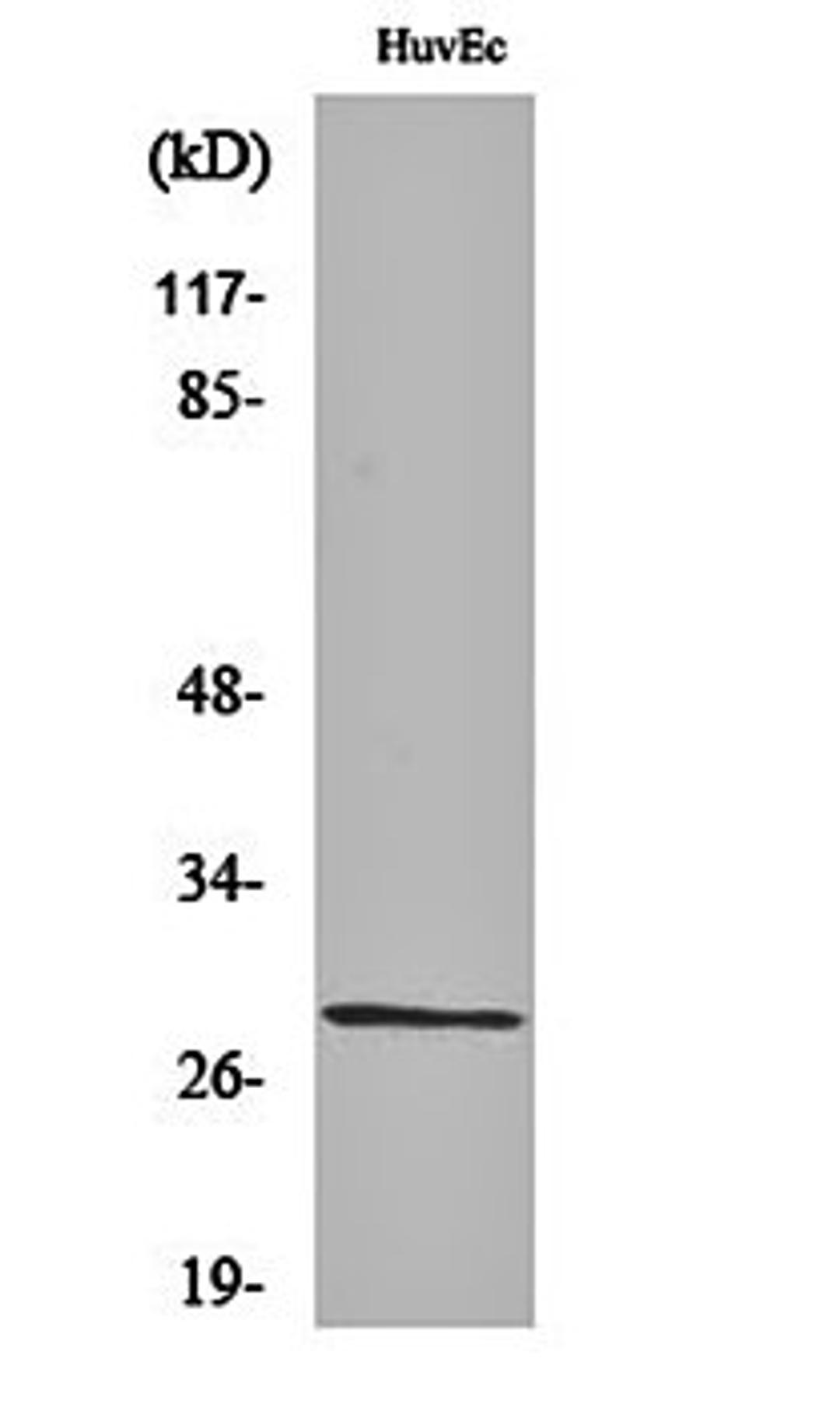 Western blot analysis of HuvEc cell lysates using Casein Kinase II beta antibody