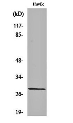 Western blot analysis of HuvEc cell lysates using Casein Kinase II beta antibody