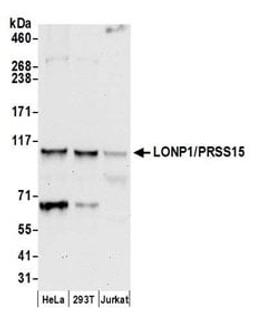 Detection of human LONP1/PRSS15 by western blot.