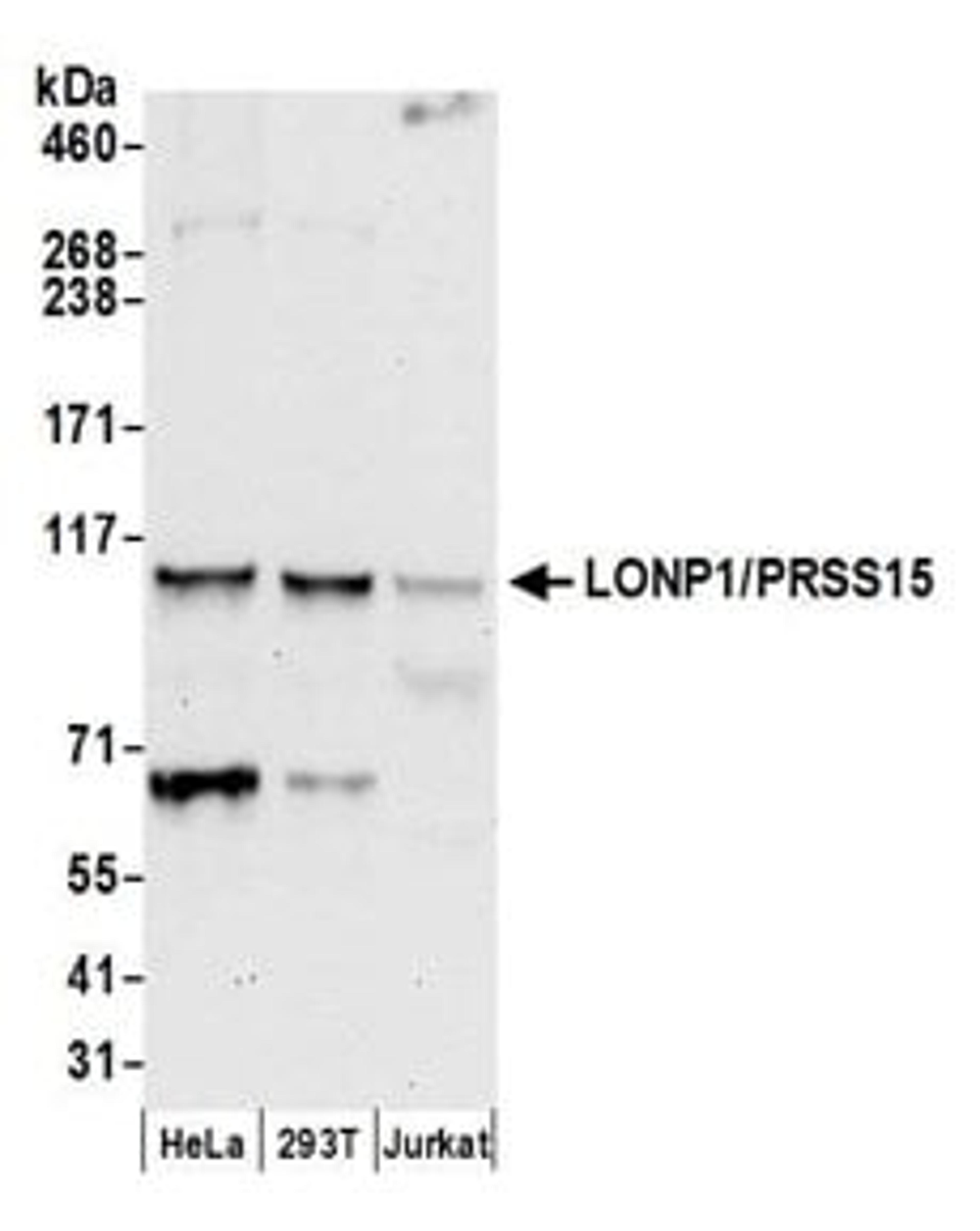 Detection of human LONP1/PRSS15 by western blot.