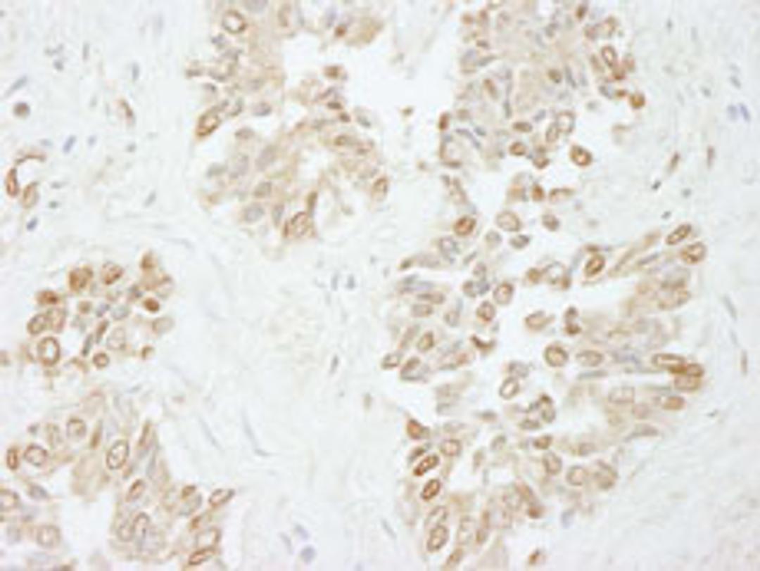 Detection of human Pol Lambda by immunohistochemistry.