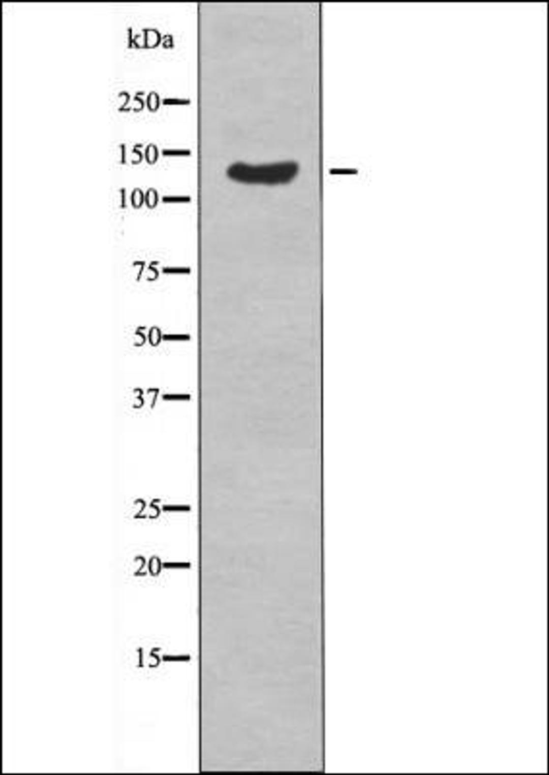 Western blot analysis of EGF treated A431 whole cell lysates using ABL1/2 -Phospho-Tyr89/Tyr70- antibody