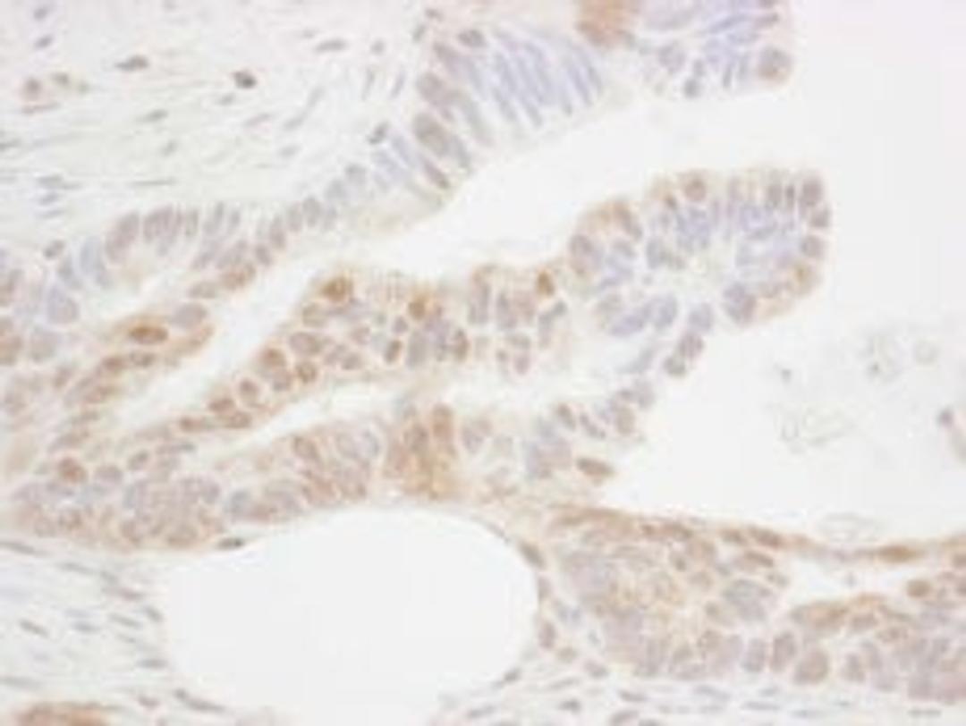 Detection of human CDX2 by immunohistochemistry.