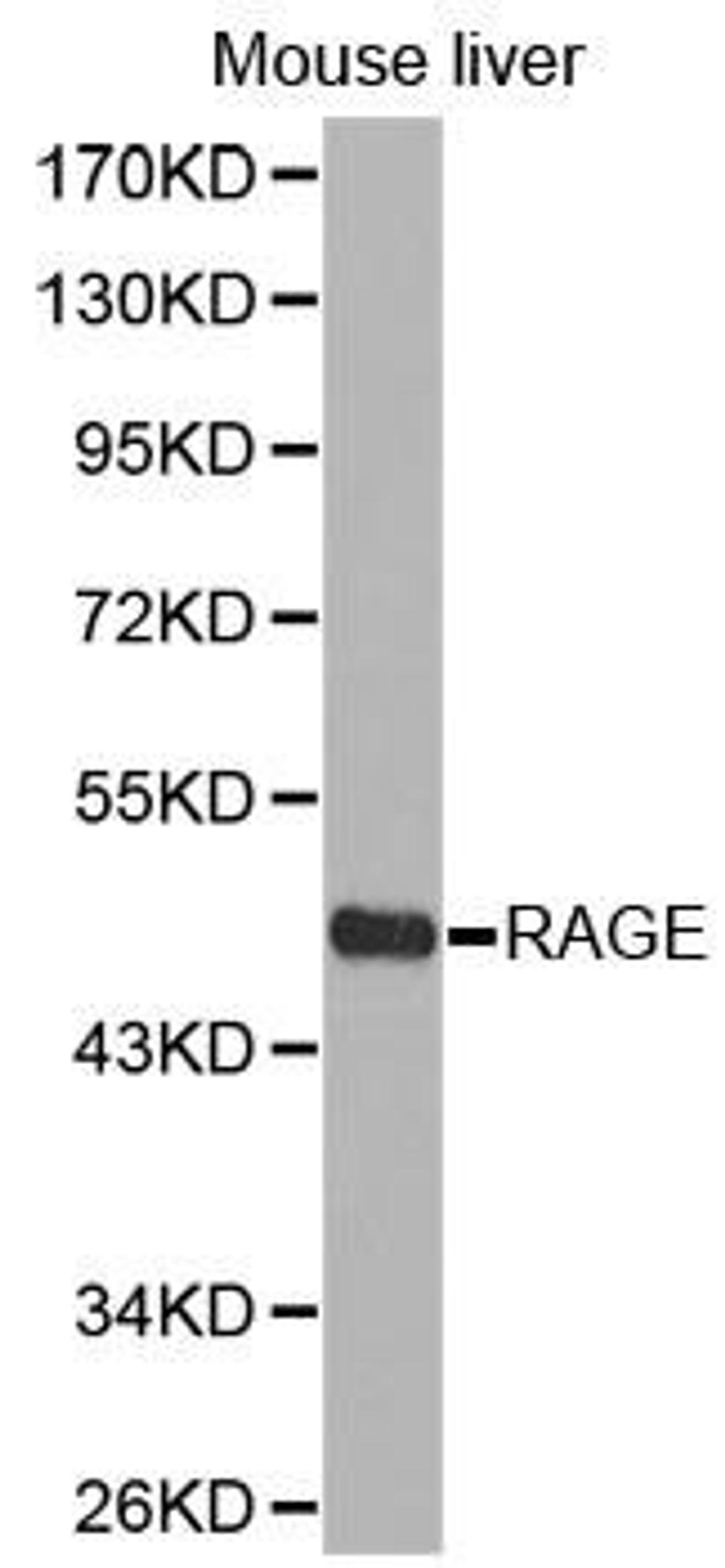 Western blot analysis of extracts of mouse liver cell lines using RAGE antibody